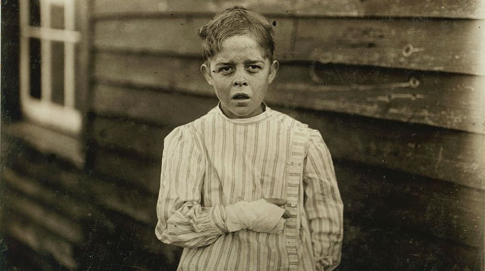 儿童工厂工人事故